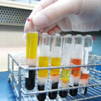 主要な血液検査方法とその正常値を紹介
